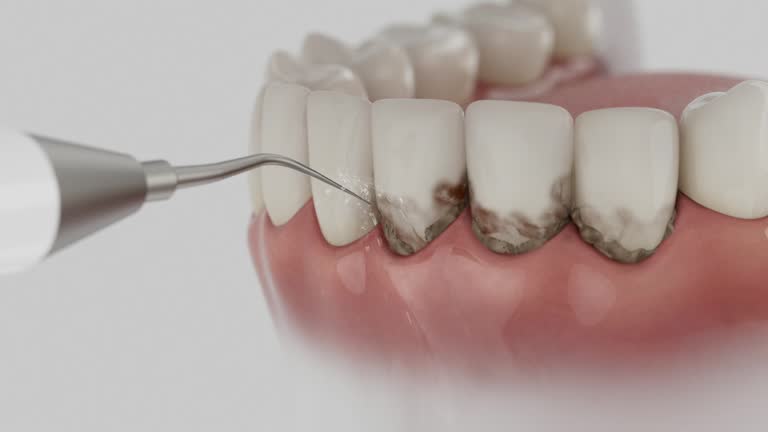 Trusted Root Canal Treatment service in Fairfield Beach, OH - Dentist Open Now